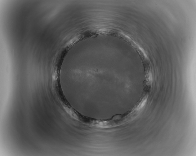 X0000087630472200705101031