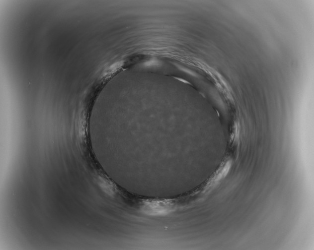 X0000087630517200705101030