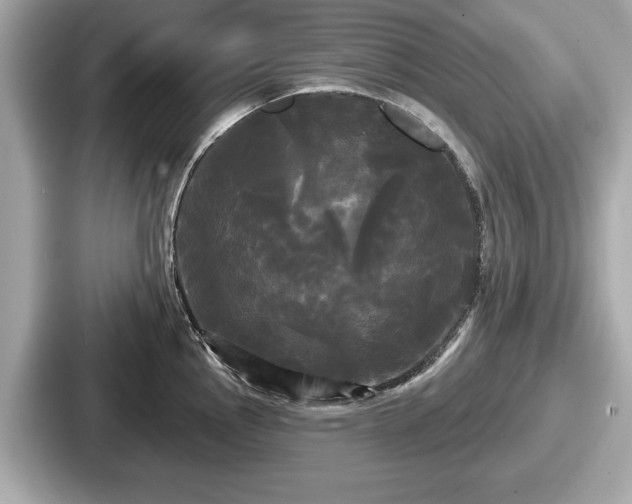 X0000087631145200705101022