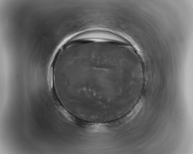 X0000087631175200705101022