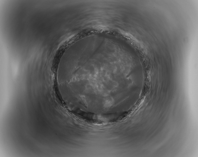 X0000087631302200705101019