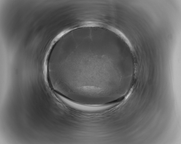 X0000087631419200705101018