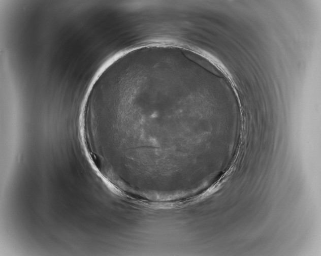 X0000087631440200705101019