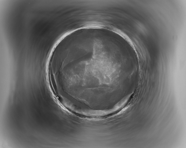 X0000087631488200705101017