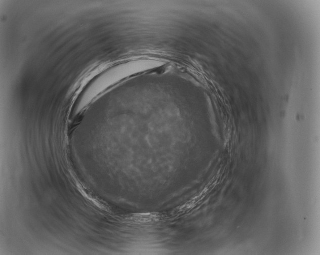 X0000087630050200705181510