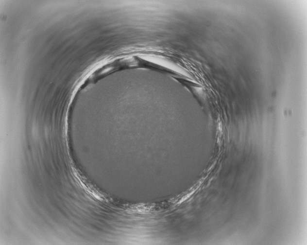 X0000087630148200705181509