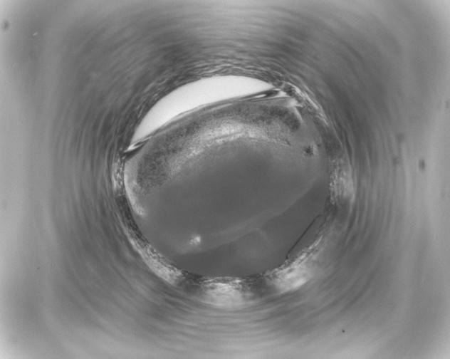 X0000087630285200705181508