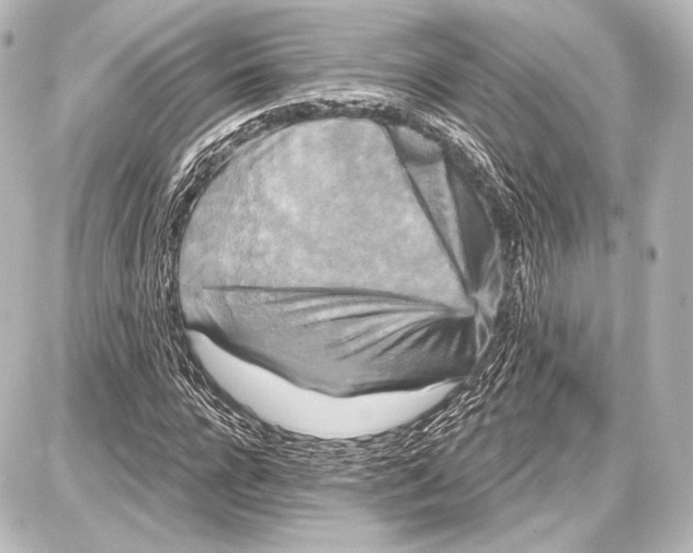 X0000087630920200705181456