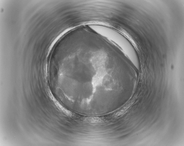 X0000087631092200705181454