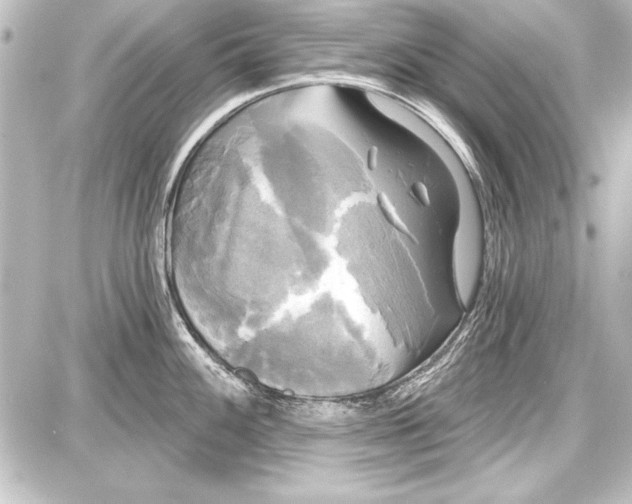 X0000087631100200705181454