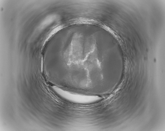 X0000087631219200705181452