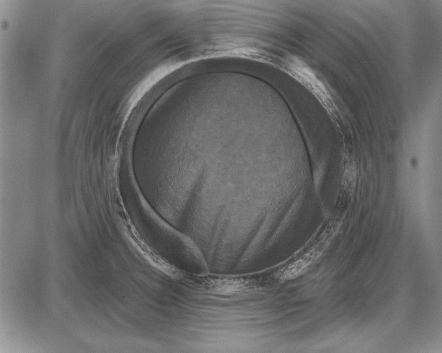 X0000087631332200705181451