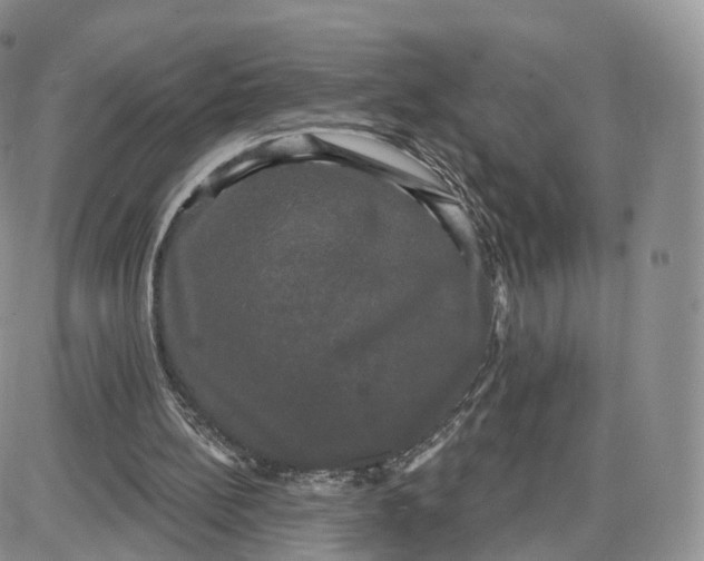 X0000087630148200705241223