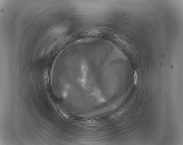 X0000087631395200705241203