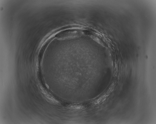 X0000087640247200705031517