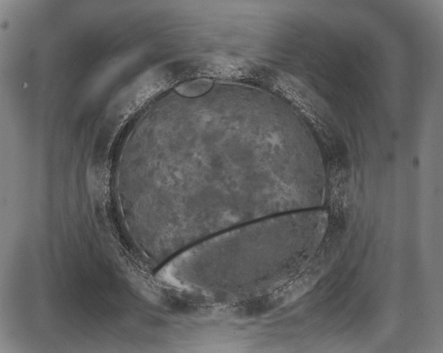 X0000087640679200705031511