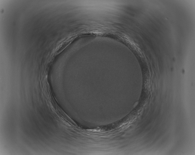 X0000087640689200705031511