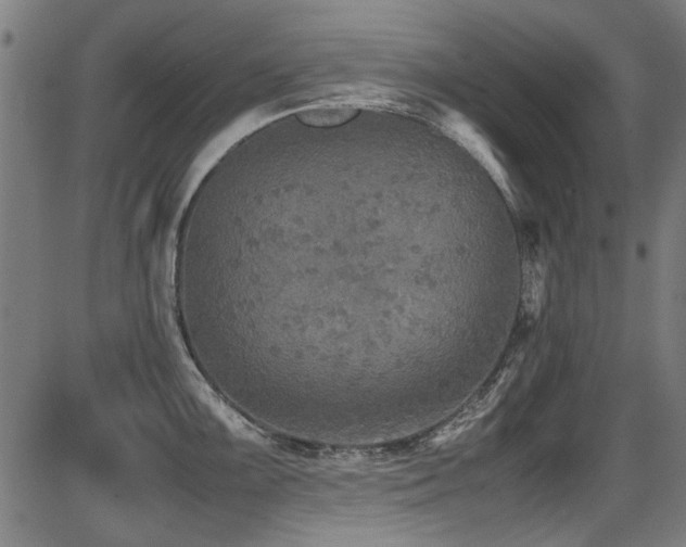 X0000087641099200705031504