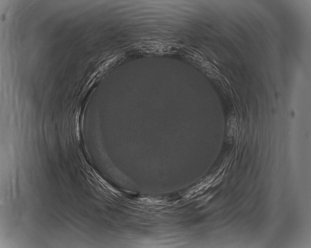 X0000087641202200705031502