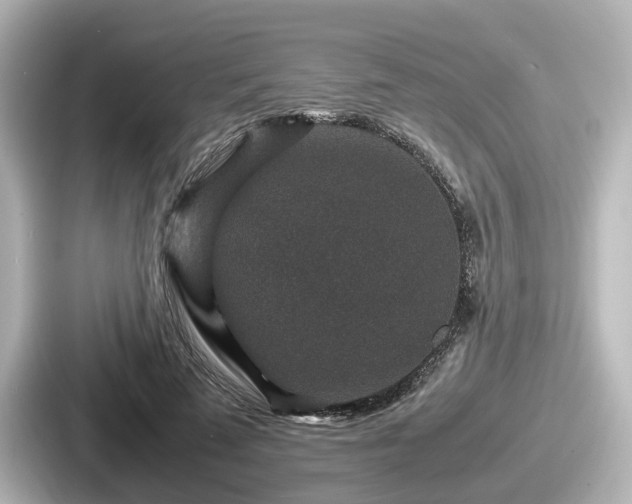 X0000087640689200705101048