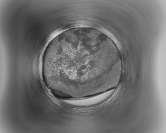 X0000087641179200705101041