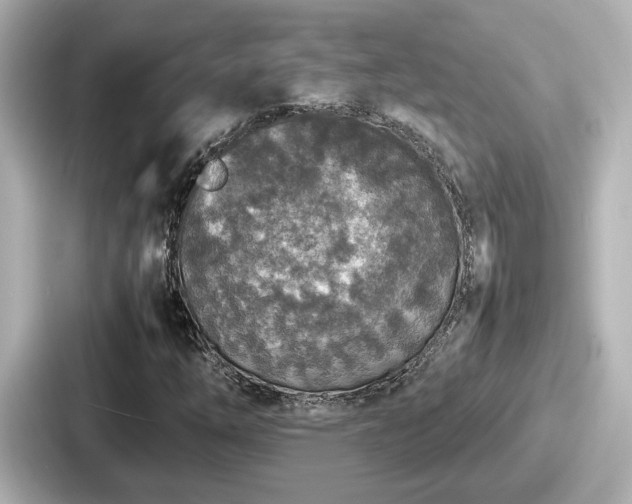 X0000087641254200705101040