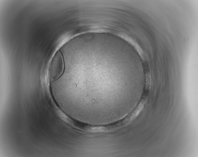 X0000087641467200705101038