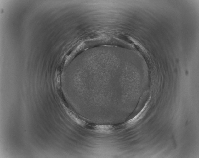 X0000087640192200705181535