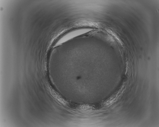 X0000087640399200705181530