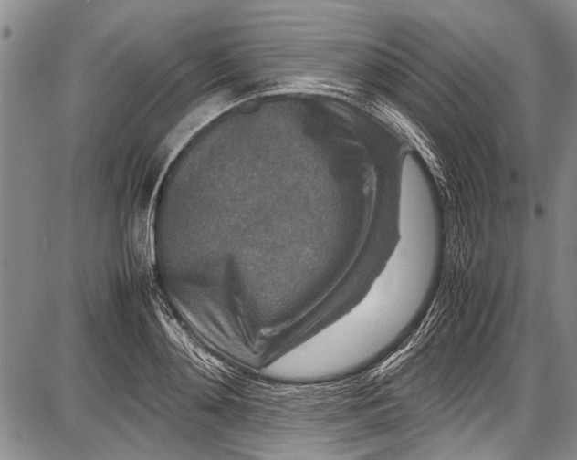 X0000087640892200705181522