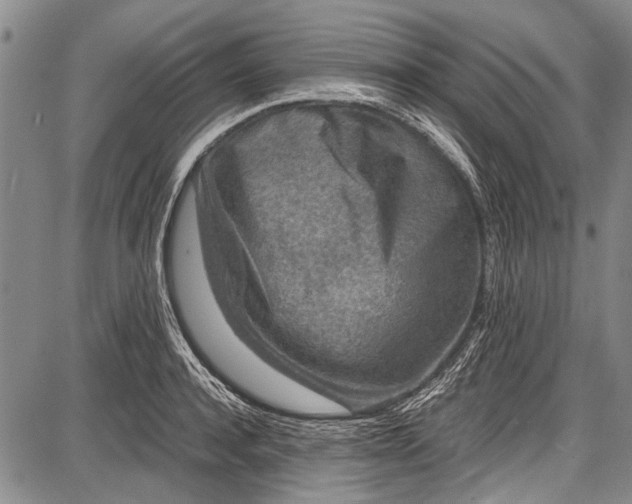 X0000087640944200705181522