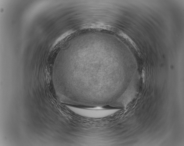 X0000087641064200705181520