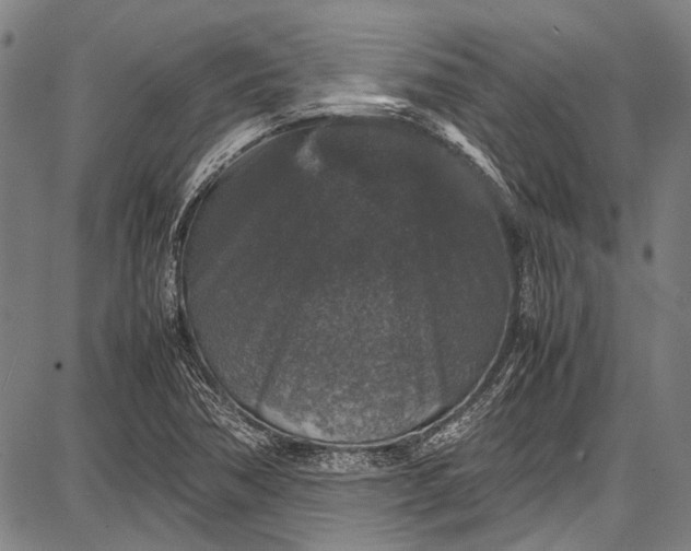 X0000087641362200705181515