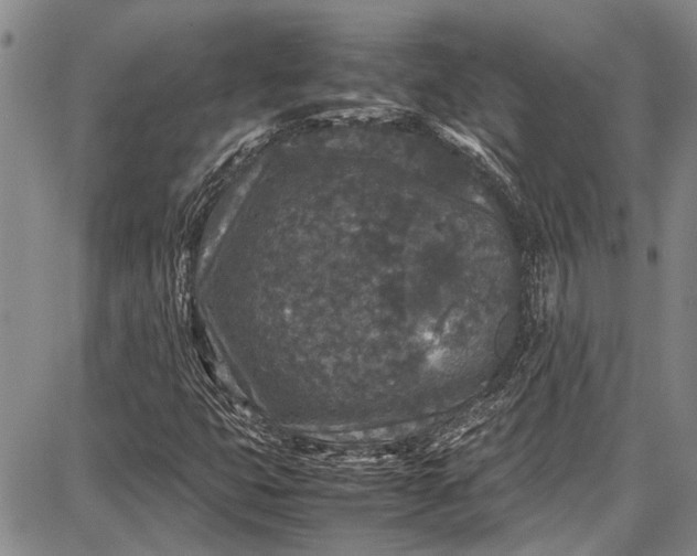 X0000087641399200705181514