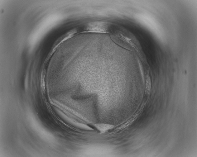 X0000087641487200705181513