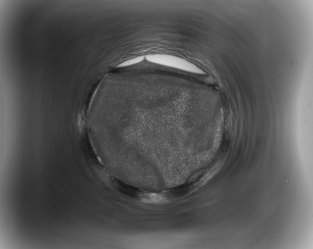 X0000087640285200705311332