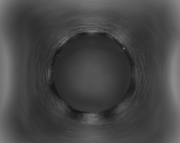 X0000087670139200705041017