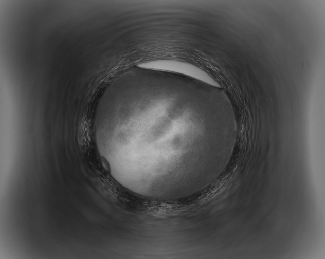 X0000087670772200705041010