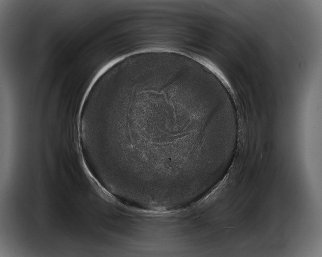 X0000087670996200705041007