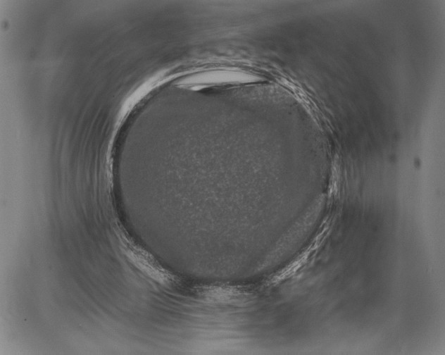 X0000087670246200705181712