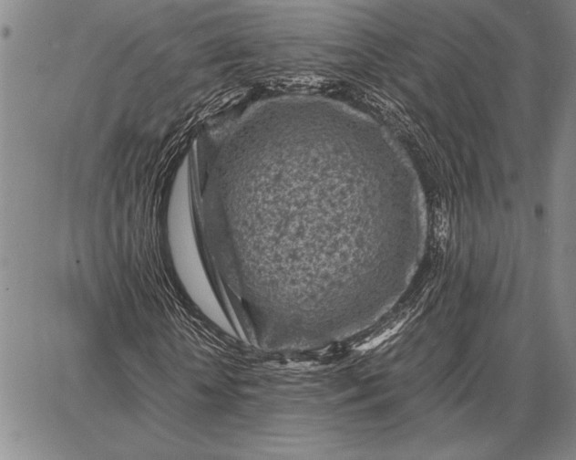 X0000087670818200705181702