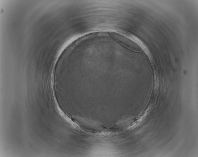 X0000087670958200705181701