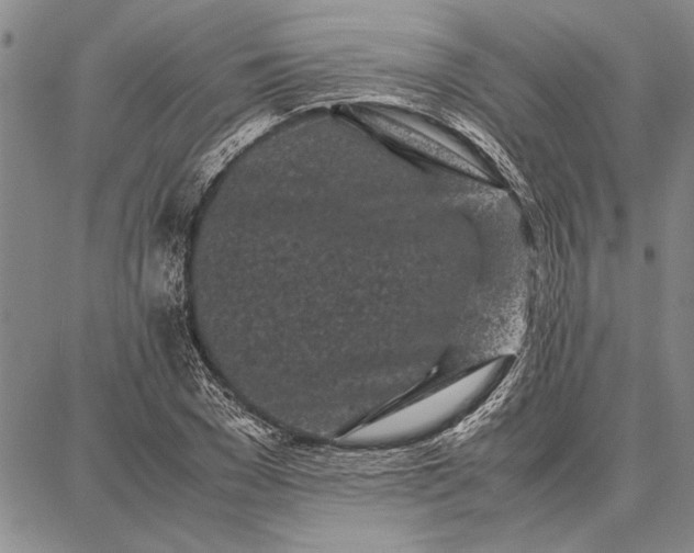 X0000087670977200705181700