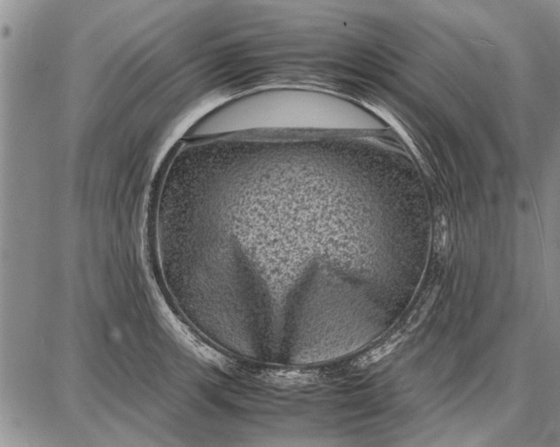 X0000087671139200705181658