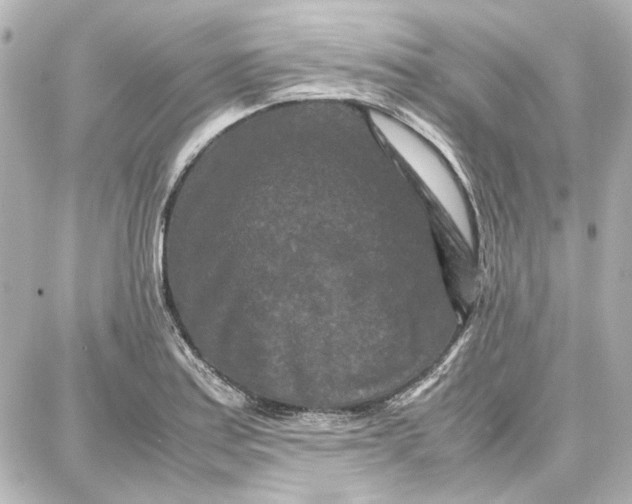 X0000087671179200705251611