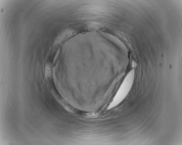 X0000087670335200706011635