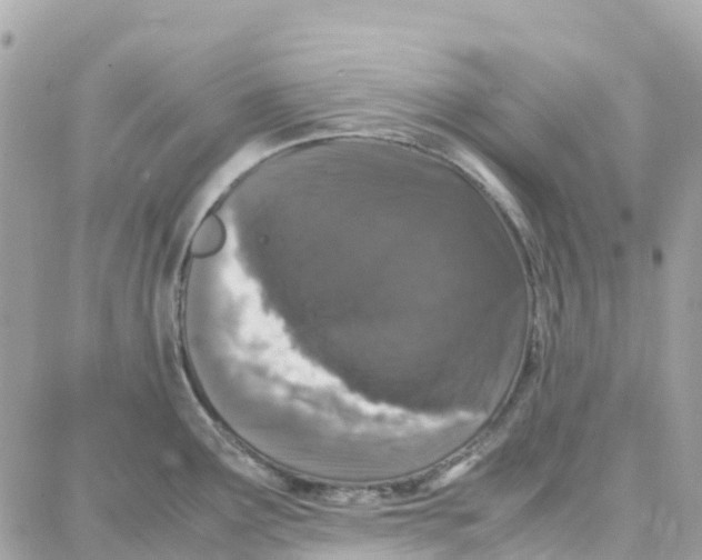 X0000087671291200706011620