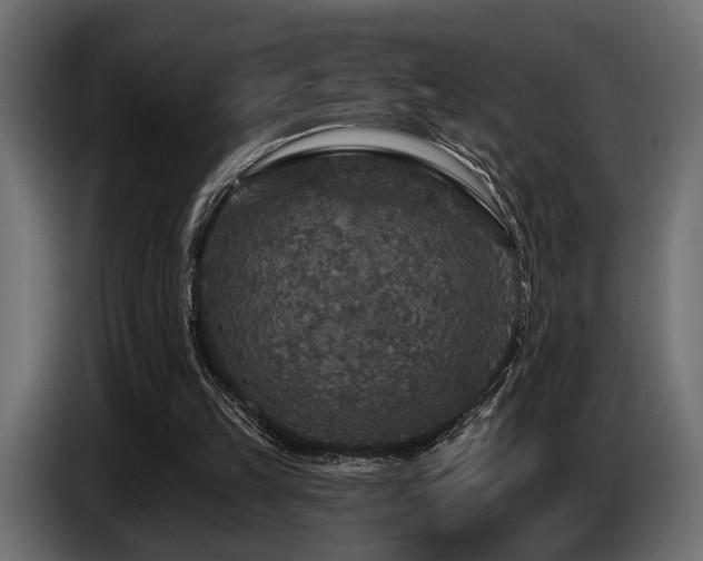 X0000087680149200705041035
