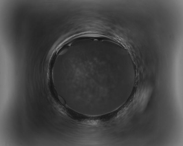 X0000087680247200705041034