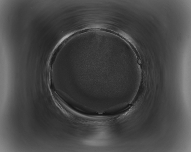 X0000087681127200705041024